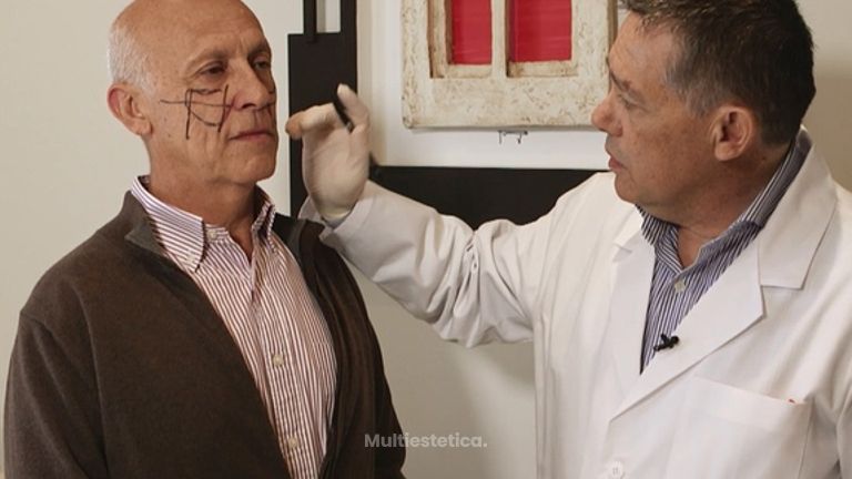 Tratamientos médico estéticos para rejuvenecer el rostro