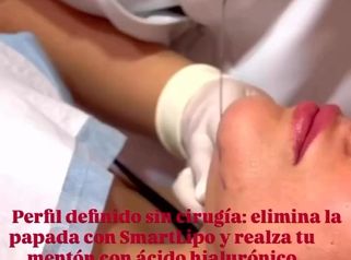 ✨ Define tu perfil facial ✨