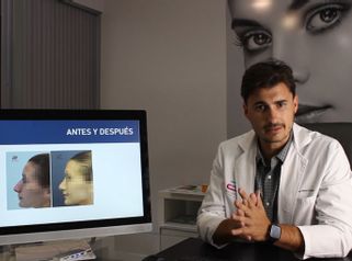 Rinoplastia - Doctor Pérez-Cerezal