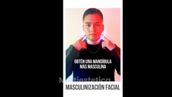 Masculinización - Clínicas DH