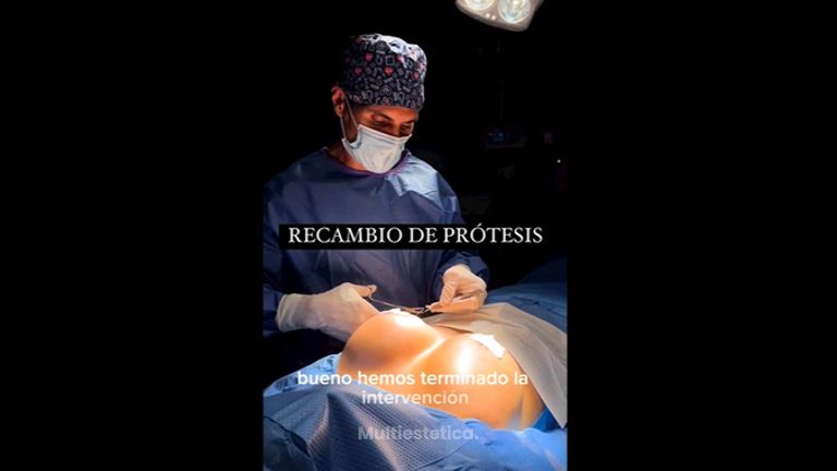 Recambio de prótesis - Clínica Dr. Jiménez