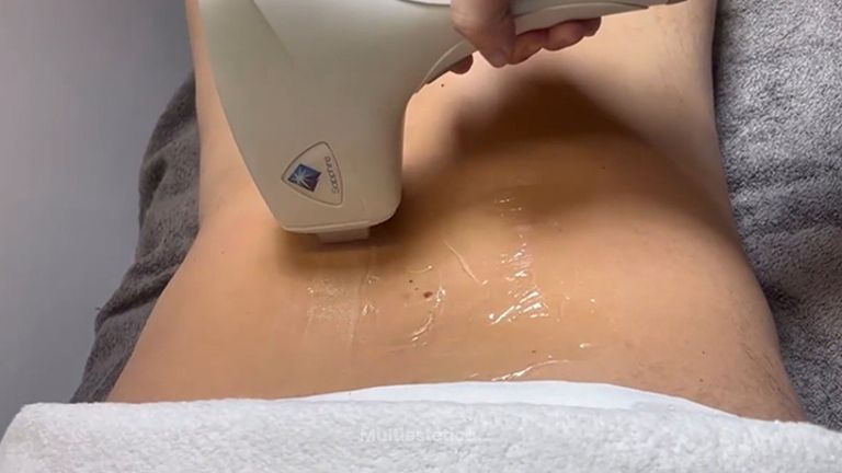 Clínica Lasernova depilación con láser médico