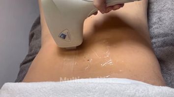 Clínica Lasernova depilación con láser médico