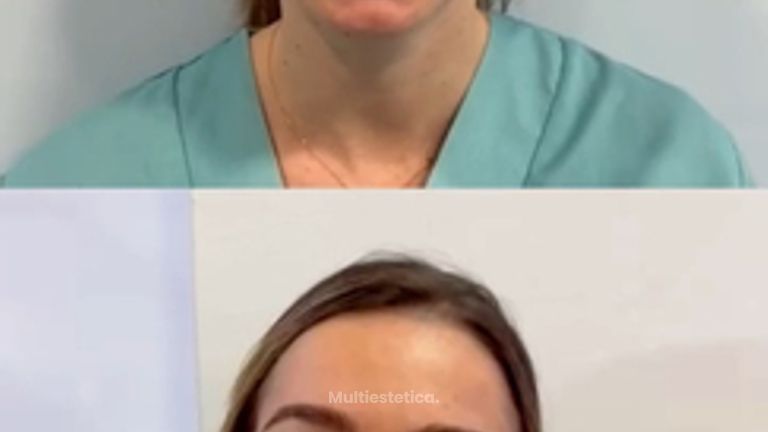 Cuando el resultado es natural, no se nota el tratamiento… se nota lo bien que estás. ✨