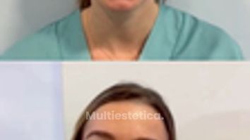 Cuando el resultado es natural, no se nota el tratamiento… se nota lo bien que estás. ✨