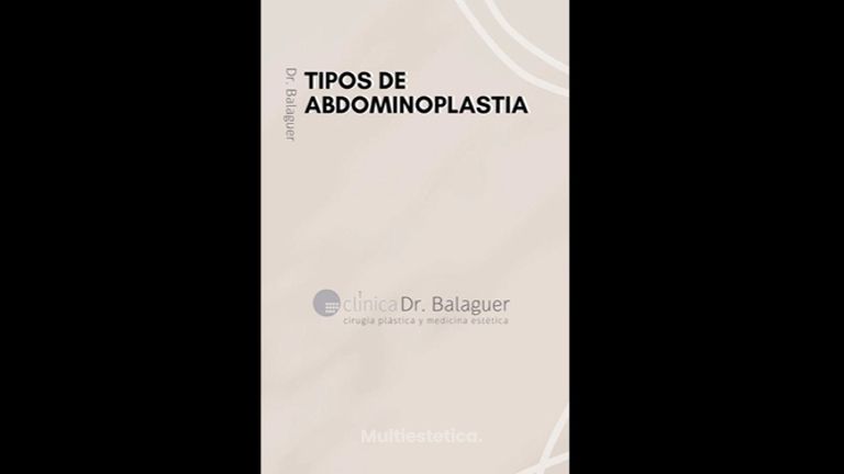 Abdominoplastia - Clinica Dr Balaguer