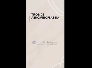 Abdominoplastia - Clinica Dr Balaguer
