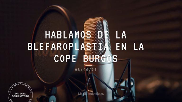 Entrevista sobre la Blefaroplastia en la COPE Burgos