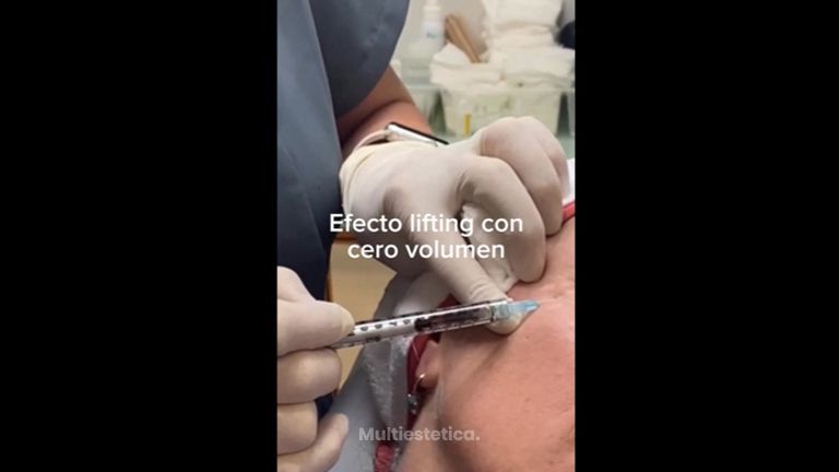 Lifting - Clínica Vega