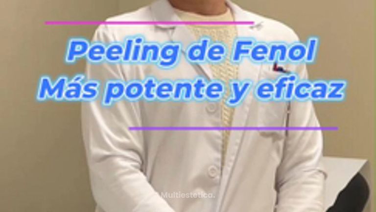 Peeling de Fenol