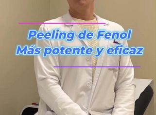 Peeling de Fenol