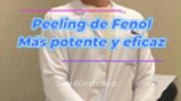 Peeling de Fenol