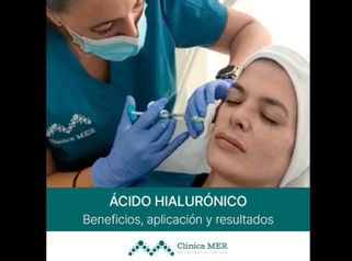 Ácido Hialurónico - Clínica MER