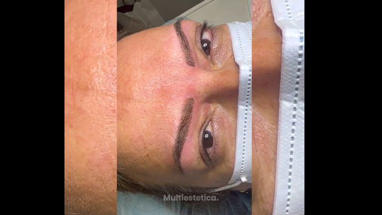 Micropigmentación - Ana Jurado