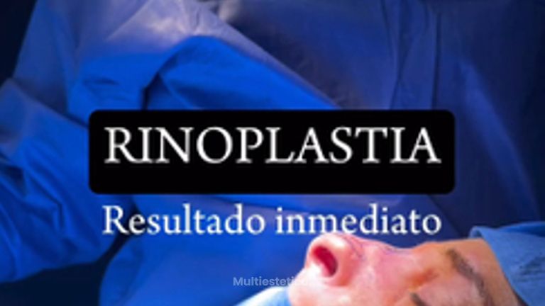 Rinoplastia - Clínica Dr. Jiménez