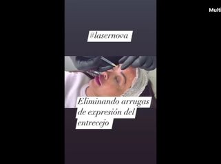 Clínica Lasernova Eliminación de arrugas