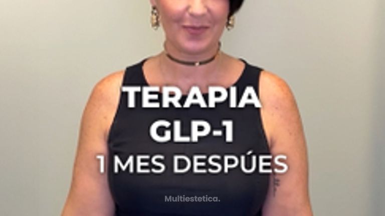 Beatriz Bernal - Terapia GLP-1 - Clínica Opción Médica