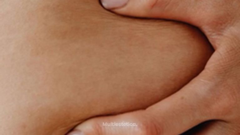 La celulitis no es un fallo.  Es algo normal
