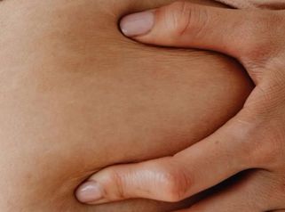 La celulitis no es un fallo.  Es algo normal