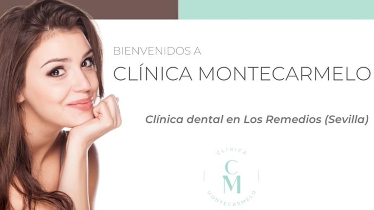 Carillas dentales - Clínica Montecarmelo