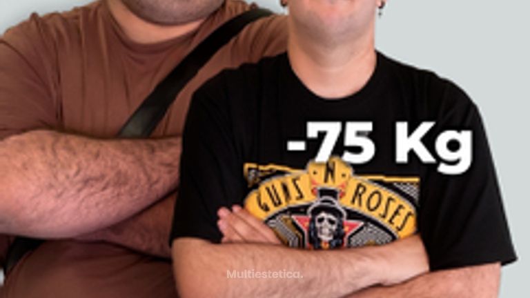 -75 kg en 1 año - Clínica Opción Médica