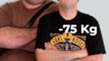 -75 kg en 1 año - Clínica Opción Médica