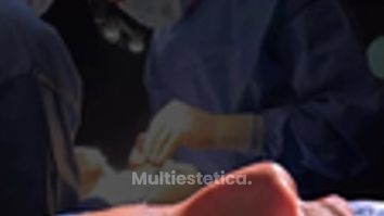 Hoy les traigo un caso de Rinoplastia Étnica
