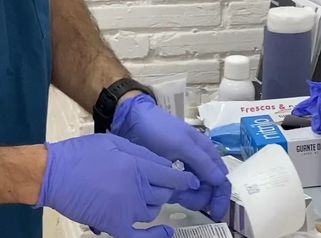 Marcación mandibular sin cirugía!!