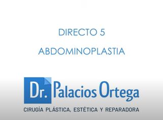 Abdominoplastia - Dr. Palacios Ortega 