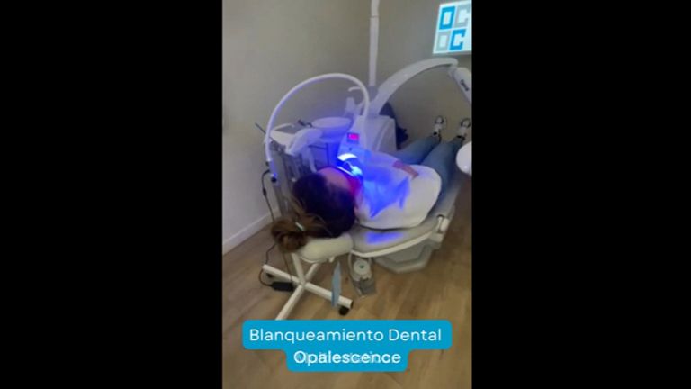 Blanqueamiento dental - OC Clinic