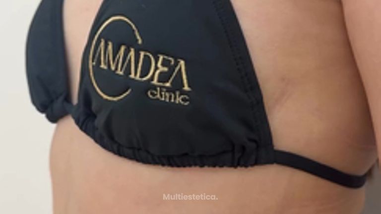 ¿Buscando un cambio que realce tu figura y tu seguridadEn Clínica Amadea te acompañamos en todo