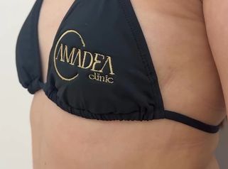 ¿Buscando un cambio que realce tu figura y tu seguridadEn Clínica Amadea te acompañamos en todo
