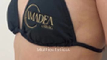 ¿Buscando un cambio que realce tu figura y tu seguridadEn Clínica Amadea te acompañamos en todo