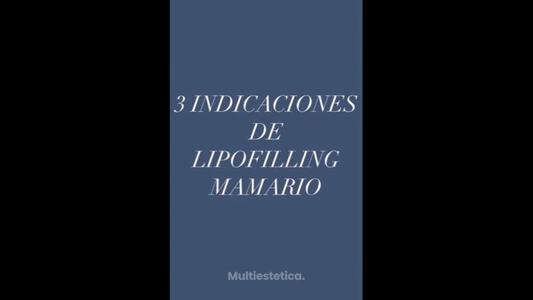 Indicaciones de Lipofilling mamario