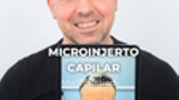 Paciente de Microinjerto Capilar