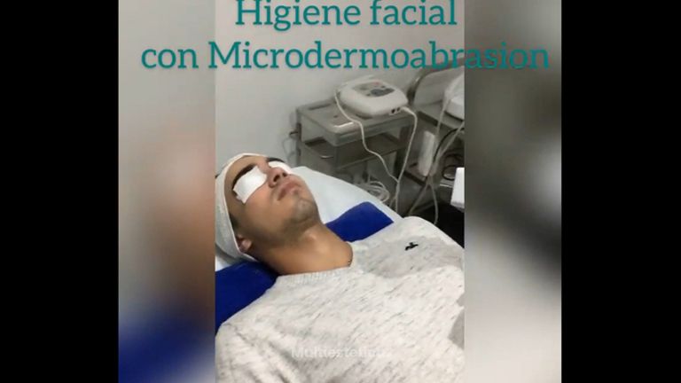 Microdermoabrasión - Dr. Juan Sergio Fernandes Andrade