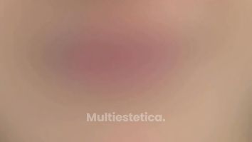 👄 Tratamiento de hidratación de labios 👄