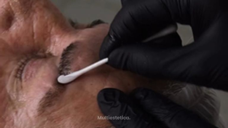 Retix- tu piel renovada y luminosa ✨Retix es un tratamiento revolucionario para renovar la piel,