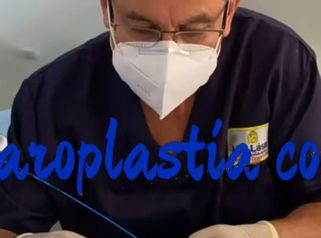BLEFAROPLASTIA 