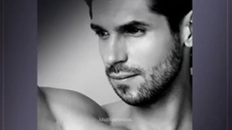 ÁCIDO HIALURÓNICO- Masculinización facial