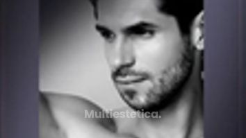 ÁCIDO HIALURÓNICO- Masculinización facial