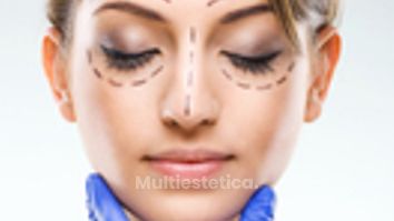 Blefaroplastia - Stetik Studio