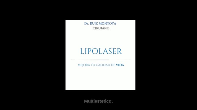 Lipoláser - Dr. Ruiz Montoya