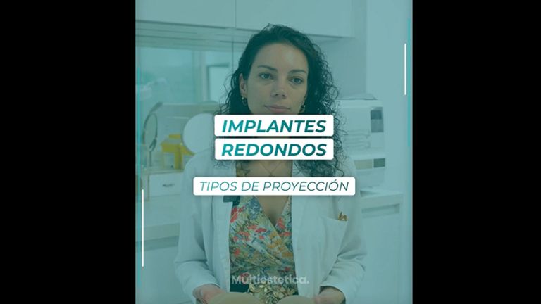 Implantes redondos - Dra. Estefanía Poza Guedes