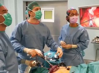 Reducción de estómago Tubo gástrico por laparoscopia a traves de una sola incisión