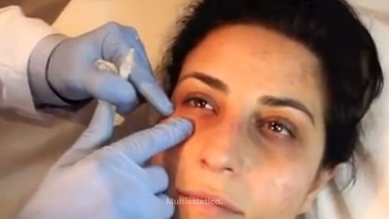 Termina con las ojeras