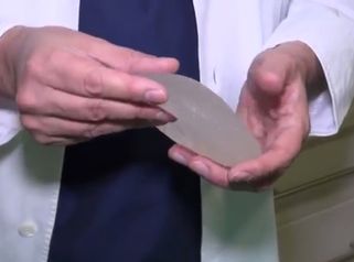¿Los implantes mamarios son para toda la vida?
