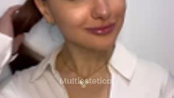 Aumento de labios femeninos