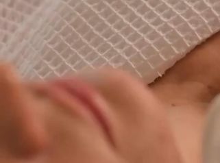 Descubre el poder del rejuvenecimiento facial con el aparato ULTRAFORMER MPT. 🌟