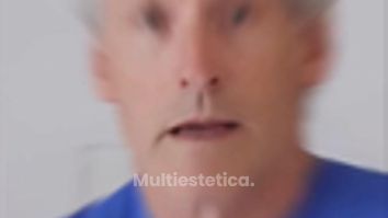 Hoy hablamos sin filtros sobre el aumento de mamas-lo que casi nunca te explican en consulta